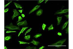Immunofluorescence of monoclonal antibody to TUBA4A on HeLa cell.