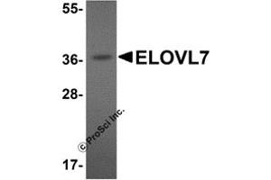 Western Blotting (WB) image for anti-ELOVL Fatty Acid Elongase 7 (ELOVL7) (N-Term) antibody (ABIN1031366) (ELOVL7 anticorps  (N-Term))