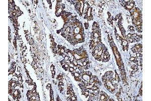 IHC analysis of Tryptophan Hydroxylase/TPH1 using anti-Tryptophan Hydroxylase/TPH1 antibody (ABIN7601556).