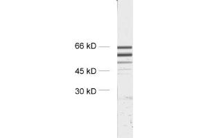 dilution: 1 : 2000, sample: crude synaptosomal fraction of rat brain (P2) (STXBP2 anticorps)