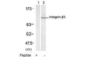 Image no. 2 for anti-Integrin beta 3 (ITGB3) (AA 771-775) antibody (ABIN197246) (Integrin beta 3 anticorps  (AA 771-775))