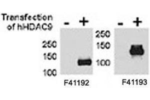 HDAC9 antibody NSJ# F41192 and NSJ# F41193 were tested by WB and IP-WB using HeLa and HeLa-HDAC9 transfected cells. (HDAC9 anticorps  (AA 2-32))