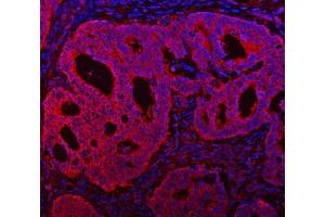 IF analysis of TMC7 using anti-TMC7 antibody (ABIN7602499).