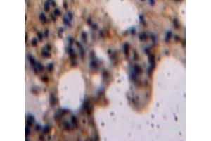 IHC-P analysis of Lung tissue, with DAB staining. (LIFR anticorps  (AA 522-691))