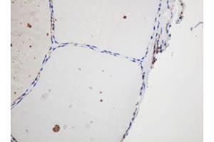 Image no. 3 for anti-Glyceraldehyde-3-Phosphate Dehydrogenase, Spermatogenic (GAPDHS) antibody (ABIN1498375) (GAPDHS anticorps)