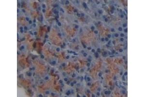 IHC-P analysis of Mouse Tissue, with DAB staining. (HAVCR1 anticorps  (AA 22-237))