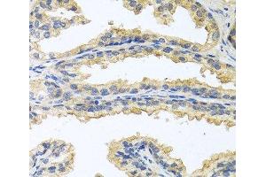 Immunohistochemistry of paraffin-embedded Human prostate using OSM Polyclonal Antibody at dilution of 1:100 (40x lens). (Oncostatin M anticorps)