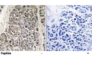 Immunohistochemistry analysis of paraffin-embedded human pancreas tissue using MRPS21 polyclonal antibody . (MRPS21 anticorps)
