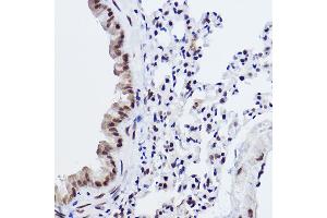 Immunohistochemistry of paraffin-embedded mouse lung using MED4 Rabbit mAb (ABIN7268445) at dilution of 1:100 (40x lens).