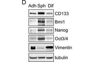 Serum-free suspension culture induces the enrichment of Glioma stem-like cells (GSCs). (Vimentin anticorps)