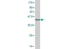 Western Blot detection against Immunogen (41. (ASK1 anticorps  (AA 1231-1374))