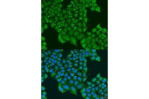 Immunofluorescence analysis of U2OS cells using ATPIF1 antibody.