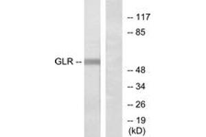 Western blot analysis of extracts from COLO205 cells, using GLR Antibody. (GLRa2 anticorps  (AA 95-144))