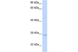 XRCC2 antibody used at 1 ug/ml to detect target protein. (XRCC2 anticorps  (Middle Region))