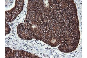 Immunohistochemistry (IHC) image for anti-Acetyl-CoA Acyltransferase 2 (ACAA2) antibody (ABIN1495726)