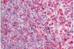 Human Spleen (formalin-fixed, paraffin-embedded) stained with CACNB2 antibody ABIN214732 at 5 ug/ml followed by biotinylated goat anti-rabbit IgG secondary antibody ABIN481713, alkaline phosphatase-streptavidin and chromogen.