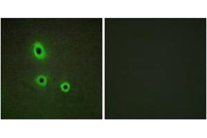 Immunofluorescence analysis of A549 cells, using EFNA5 Antibody. (Ephrin A5 anticorps  (AA 31-80))