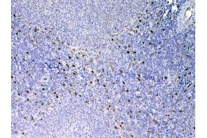 IHC analysis of IL33 using anti-IL33 antibody .