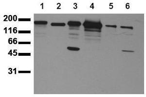 Western Blotting (WB) image for anti-Receptor tyrosine-protein kinase erbB-2 (ErbB2/Her2) (AA 1240-1260) antibody (ABIN126791) (ErbB2/Her2 anticorps  (AA 1240-1260))