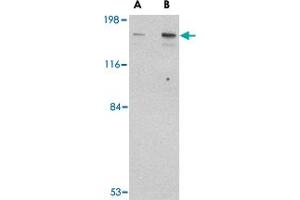 Western blot analysis of CLIP1 in rat brain tissue lysate with CLIP1 polyclonal antibody  at (A) 0. (CLIP1 anticorps  (C-Term))