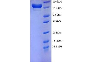 SDS-PAGE (SDS) image for Matrix Metallopeptidase 14 (Membrane-inserted) (MMP14) (AA 112-582) protein (His-SUMO Tag) (ABIN5709943)