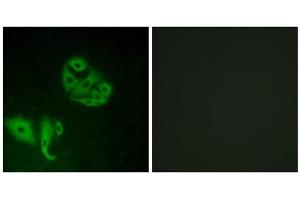 Immunofluorescence analysis of A549 cells, using GPR20 antibody. (GPR20 anticorps  (C-Term))