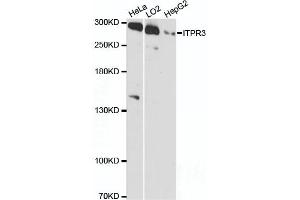 Western blot analysis of extracts of various cell lines, using ITPR3 antibody (ABIN6132120, ABIN6142616, ABIN6142617 and ABIN6216547) at 1:3000 dilution.