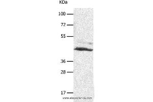 Western blot analysis of A549 cell, using SLC16A7 Polyclonal Antibody at dilution of 1:450 (SLC16A7 anticorps)