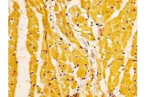 IHC image of ABIN7151847 diluted at 1:200 and staining in paraffin-embedded human heart tissue performed on a Leica BondTM system.