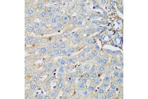 Immunohistochemistry of paraffin-embedded rat liver using PROCR antibody (ABIN6291490) at dilution of 1:200 (40x lens). (PROCR anticorps)
