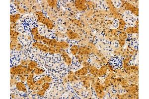 ABIN7095895 and ABIN7099957 at 1/100 staining mouse kidney tissue by IHC-P. (RDH12 anticorps)