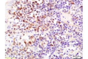 Formalin-fixed and paraffin embedded mouse spleen labeled with Rabbit Anti IGFR3/CD16 Polyclonal Antibody, Unconjugated  at 1:200 followed by conjugation to the secondary antibody and DAB staining