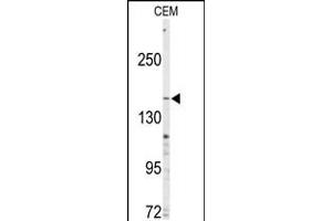 Western blot analysis of anti-ABCC4 Antibody in CEM cell line lysates (35ug/lane) (ABCC4 anticorps  (C-Term))