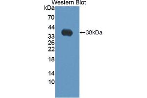 Western blot analysis of the recombinant protein. (SFRP1 anticorps  (AA 32-314))