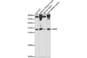 Western blot analysis of extracts of various cell lines, using MYF6 antibody (ABIN6291680) at 1:1000 dilution. (MYF6 anticorps)
