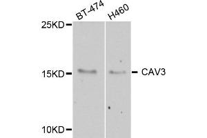 Western blot analysis of extract of various cells, using CAV3 antibody. (Caveolin 3 anticorps)