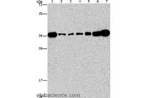 Western blot analysis of Lovo, A431, A549, hela, hepG2 and Raji cell, mouse brain tissue, using CRKL Polyclonal Antibody at dilution of 1:550