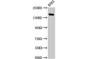 Western Blot Positive WB detected in: K562 whole cell lysate All lanes: FGD6 antibody at 2. (FGD6 anticorps  (AA 1138-1352))