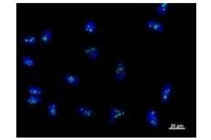 Immunostaining analysis in HeLa cells. (RPF2 anticorps)