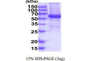 SDS-PAGE (SDS) image for Killer Cell Immunoglobulin-Like Receptor, Two Domains, Long Cytoplasmic Tail, 4 (KIR2DL4) (AA 24-242) protein (hIgG-His-tag) (ABIN6388078) (KIR2DL4/CD158d Protein (AA 24-242) (hIgG-His-tag))