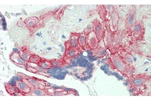 Detection of CD276 in Human Placenta Tissue using Polyclonal Antibody to Cluster Of Differentiation 276 (CD276)