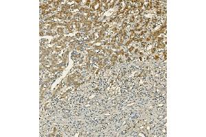 IHC analysis of LIPC using anti-LIPC antibody (ABIN7601582). (LIPC anticorps  (AA 39-494))