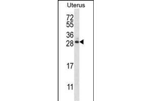 ARL8A Antibody (Center) (ABIN657381 and ABIN2846426) western blot analysis in human normal Uterus tissue lysates (35 μg/lane). (ARL8A anticorps  (AA 82-110))