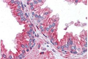 Prostate: Formalin-Fixed, Paraffin-Embedded (FFPE)