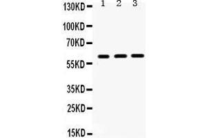 Western Blotting (WB) image for anti-HNF1 Homeobox B (HNF1B) (AA 496-525), (C-Term) antibody (ABIN3042452)