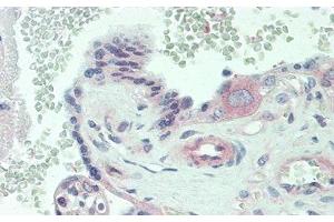 anti-Interleukin 6 Receptor (IL6R) antibody