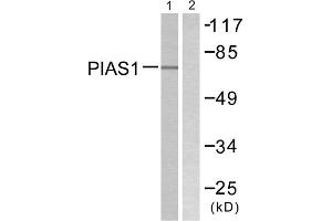 Western blot analysis of extracts from MDA-MB-435 cells, using PIAS1 antibody.