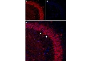 Expression of P2RY1 in mouse hippocampus - Immunohistochemical staining of mouse hippocampal CA3 region using Anti-P2Y1 Receptor (extracellular) Antibody (ABIN7043584, ABIN7045094 and ABIN7045095).