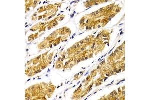 Immunohistochemistry of paraffin-embedded Human gastric using ABO antibody at dilution of 1:100 (x400 lens). (ABO anticorps)