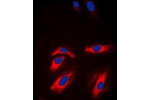 Immunofluorescent analysis of Creatine Kinase M staining in NIH3T3 cells.
